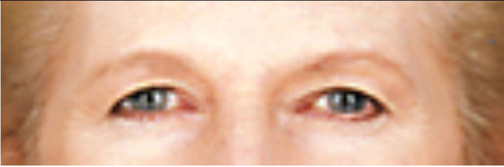 eyes2 image