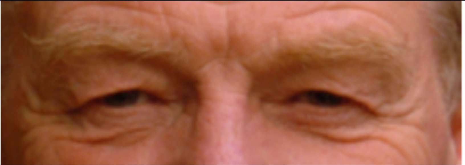 eyes3 image